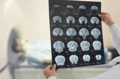 AI mở ra hướng giải mã những bí ẩn y học cho bệnh nhân