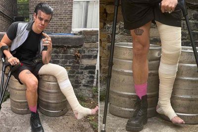 Yungblud gãy chân trong tai nạn xe máy, tuyên bố vẫn biểu diễn