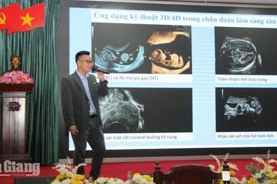 Bệnh viện Sản - Nhi Kiên Giang cập nhật ứng dụng AI trong siêu âm