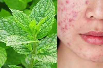 Da mụn nên ăn rau gì cho mát? Mẹo làm đẹp da đơn giản từ các loại rau quen thuộc