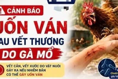 Vết thương do gà mổ, cụ bà 86 tuổi nhập viện vì uốn ván