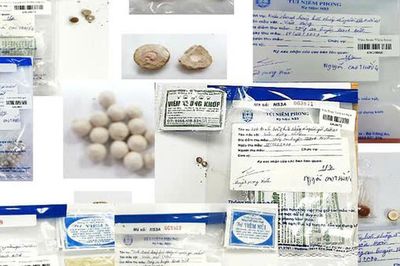 Uống thuốc 'gia truyền' mua trên mạng, người đàn ông bị Gút cấp nặng