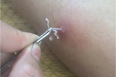 Giun rồng lại xuất hiện ở Việt Nam