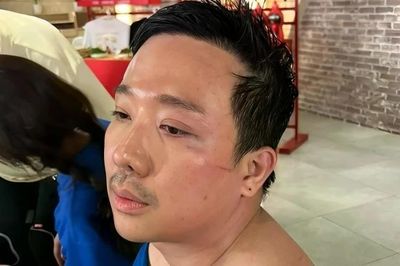Trấn Thành chỉ ngủ 12 phút/ngày