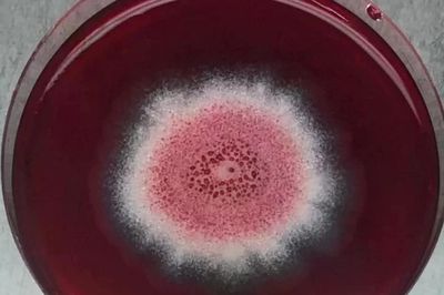 Nghiên cứu của Malaysia: Nấm Nam Cực mở ra hy vọng mới về thuốc điều trị Alzheimer