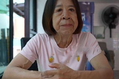 Suốt nhiều năm bị gọi là 'đồ nhăn nheo' do mắc hội chứng hiếm gặp, cô gái 29 tuổi hy vọng về tương lai sau ca phẫu thuật thay đổi diện mạo