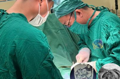 Người đàn ông 54 tuổi phát hiện ung thư bàng quang từ dấu hiệu nhiều người Việt mắc phải