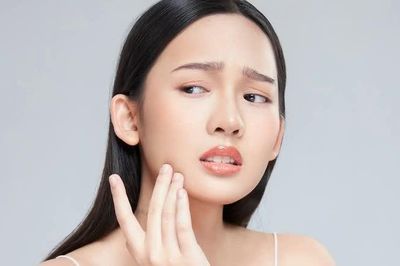 Làm thế nào để xử lý hiệu quả mụn ẩn viêm hay những nốt mụn 'nằm lì' dưới da?