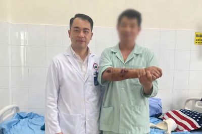 Lâm Đồng: Nối thành công cánh tay đứt gần lìa do máy nghiền đá