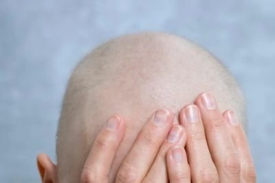 Mỗi năm Việt Nam ghi nhận 120.000 ca ung thư mới, tỷ lệ tử vong cao