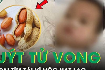 Bé trai 2 tuổi tím tái, suýt tử vong vì hóc hạt lạc
