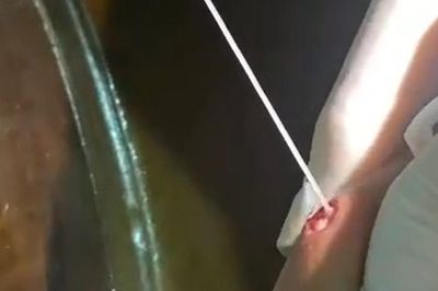 Chuyên gia cảnh báo nguy cơ bệnh giun rồng từ nước khe, suối và rừng rẫy