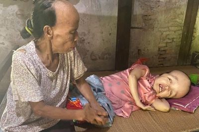 Mẹ 70 tuổi chống nạng chăm con liệt giường hơn 30 năm, sợ ngày không còn sức