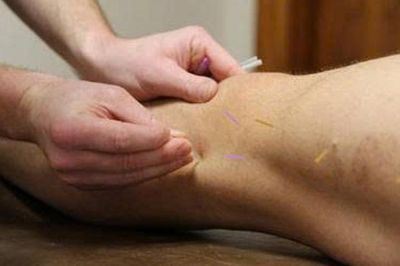 Ngồi lâu, ít vận động, bệnh suy giãn tĩnh mạch ngày càng phổ biến