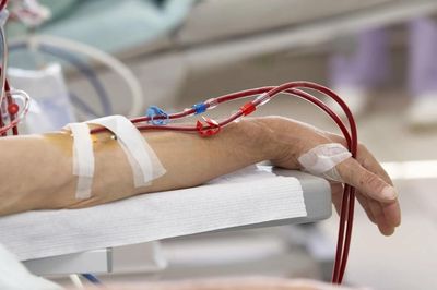 4 việc cần làm ngay để bảo vệ hai quả thận trước khi quá muộn