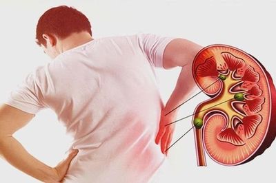 Muốn hai quả thận khỏe, nhất định đừng bỏ qua 4 thói quen này