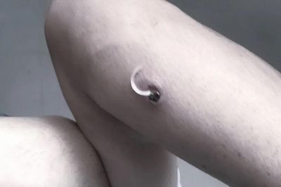 Loài giun có cách lây lan gây đau đớn, nguy hiểm khi tự ý rút ra