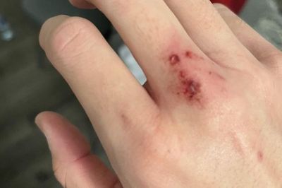 Căn bệnh nguy hiểm khiến bé gái ở Đồng Tháp ra đi trong đau xót