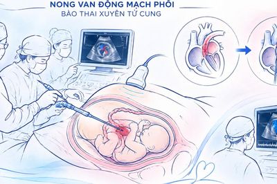 Thành phố Hồ Chí Minh thông tim bào thai ca thứ 15 thành công