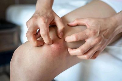 7 tín hiệu 'lên tiếng' hiếm hoi khi gan bắt đầu giảm chức năng