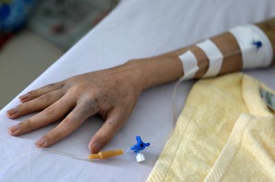 Vì sao ung thư đang tấn công ngày càng nhiều người trẻ?