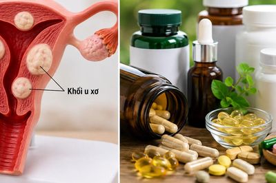 Người bệnh u xơ tử cung nên thận trọng với những thực phẩm chức năng nào?