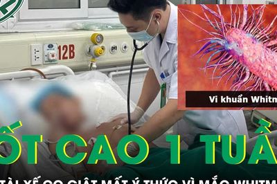 Sau một tuần sốt cao, nam tài xế 54 tuổi phát hiện mắc Whitmore