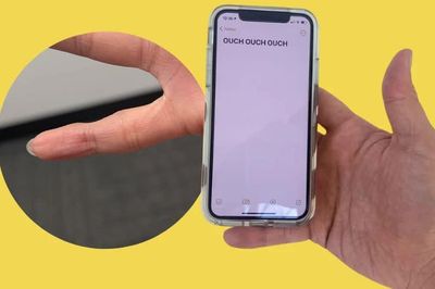 Hội chứng 'ngón út smartphone' là gì, có phải chỉ xảy ra ở Gen Z như lời đồn?