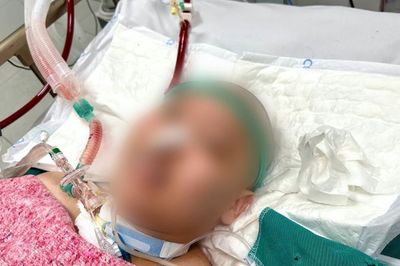 Nam thanh niên 25 tuổi suy đa tạng nguy kịch vì căn bệnh tự miễn
