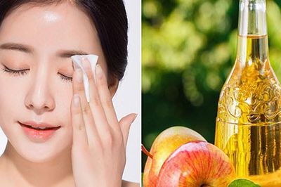 Bí quyết trị mụn nang và giữ dáng thon gọn nhờ giấm táo
