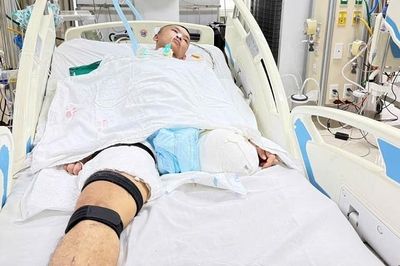Chàng trai 22 tuổi gặp tai nạn nguy kịch, gia đình chật vật lo chi phí điều trị