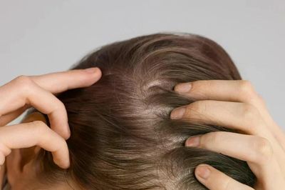Thuốc trị viêm khớp lại có thể giúp mọc tóc, kết quả thử nghiệm khiến giới khoa học chú ý