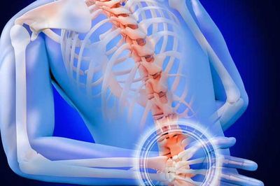 3 bí quyết phòng ngừa viêm cột sống dính khớp