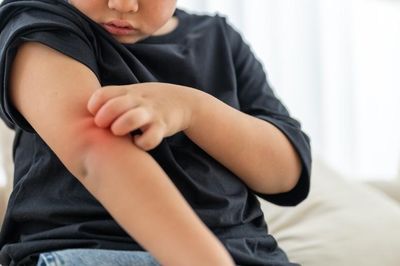 Trẻ nhỏ khi nào nên tẩy giun?