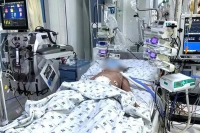 Liên tiếp cứu sống trẻ bị suy tạng do sốc sốt xuất huyết nặng
