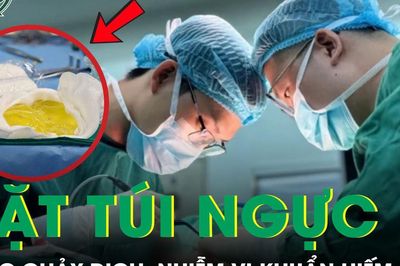 Đặt túi ngực 2 lần, người phụ nữ 38 tuổi nhiễm vi khuẩn hiếm gặp