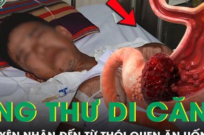 Mắc ung thư dạ dày di căn, nam tài xế 'bật khóc' vì nguyên nhân