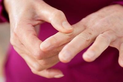 Run ở người trẻ có thể là dấu hiệu tổn thương thần kinh