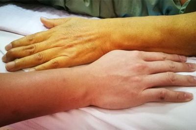 4 thay đổi trên móng tay, tóc và da không nên xem nhẹ
