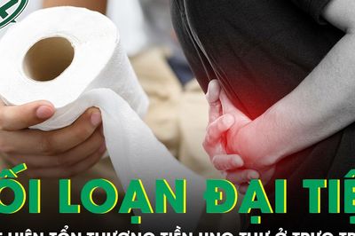 Rối loạn đại tiện kéo dài, phát hiện tổn thương tiền ung thư ở trực tràng