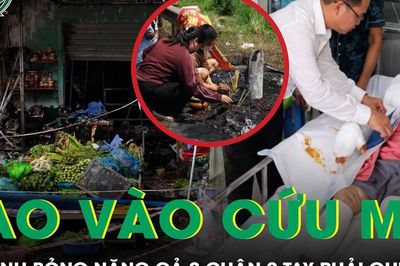 Giữa biển lửa, nữ sinh 16 tuổi lao vào cứu mẹ, bỏng nặng 2 chân 2 tay