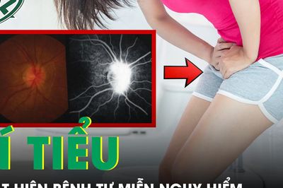 Bí tiểu kéo dài, người phụ nữ phát hiện bệnh tự miễn nguy hiểm