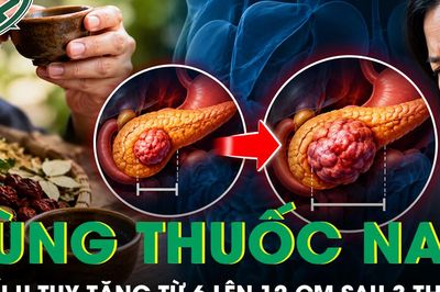 Ba tháng dùng thuốc nam, khối u tụy tăng từ 6 lên 12 cm