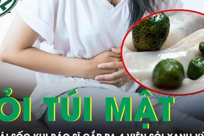 Cô gái 'sốc' khi bác sĩ gắp 4 viên sỏi xanh kỳ lạ trong túi mật
