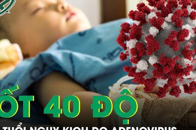 Bé trai 4 tuổi sốt 40 độ liên tục do Adenovirus, những dấu hiệu cần cảnh giác