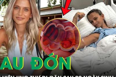 Vừa sinh con được 90 ngày, mẹ bỉm đau đớn phát hiện ung thư di căn