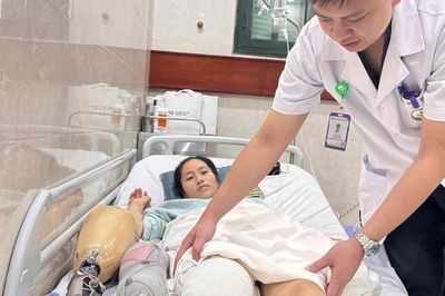 Cô giáo bị xe tải cán khi lao ra cứu học sinh được hỗ trợ lắp chân giả