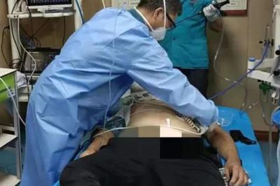 Người đàn ông 45 tuổi tử vong sau khi đau bụng, bác sĩ cảnh báo chớ ăn 3 món này