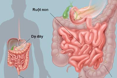 5 sai lầm khi chăm sóc người cao tuổi bị khó tiêu kéo dài