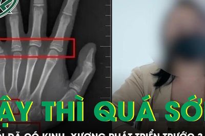 Bé gái 9 tuổi đã có kinh nguyệt, tuổi xương phát triển trước gần 3 năm